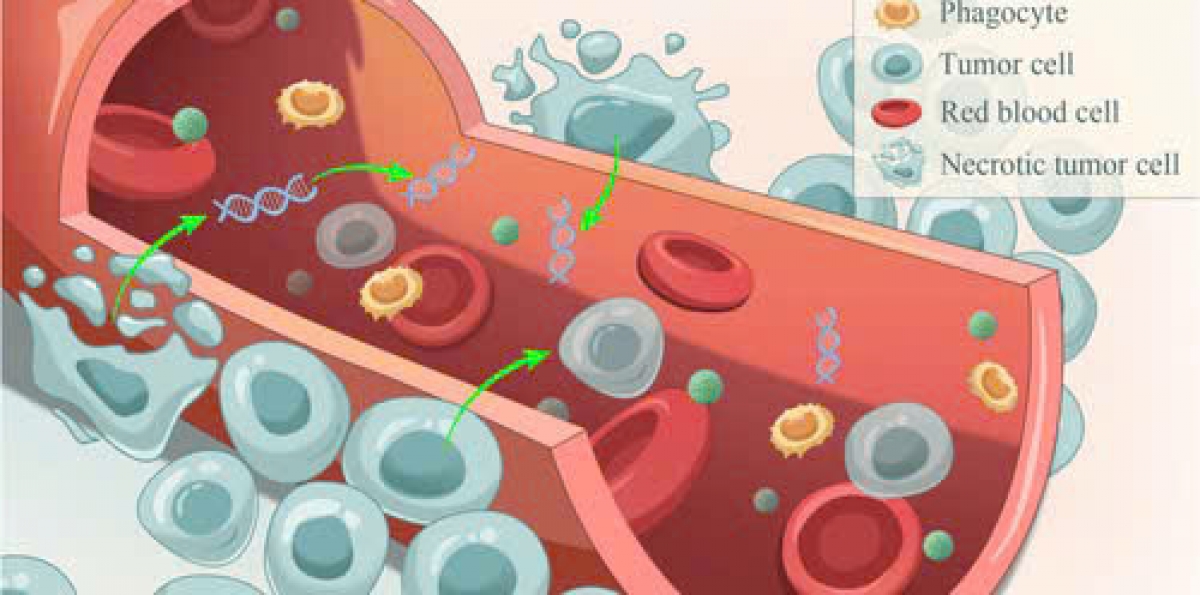 Kết quả sinh thiết lỏng sẽ tìm ra các tế bào ung thư lưu hành và DNA khối u tự do trong máu. Ảnh: KT