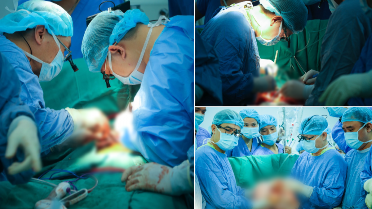Hình ảnh các bác sĩ thực hiện ca ghép tim-phổi trong phòng phẫu thuật (Nguồn: BVCC)