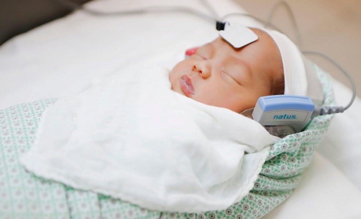 Trẻ được đo thính lực ngay sau sinh. Ảnh: BVCC