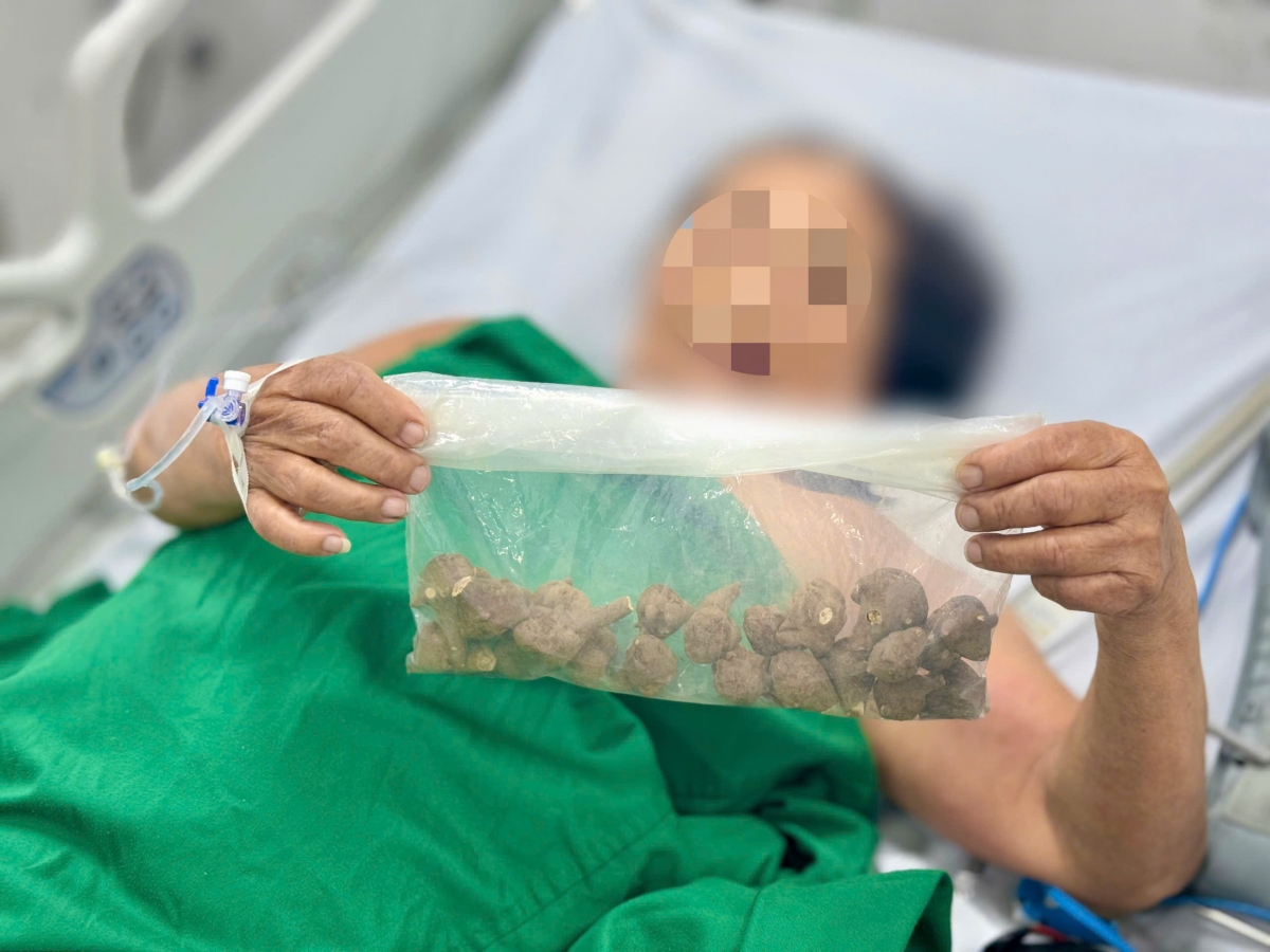 Bệnh nhân N.T.S với túi ấu tàu được đặt mua qua mạng 