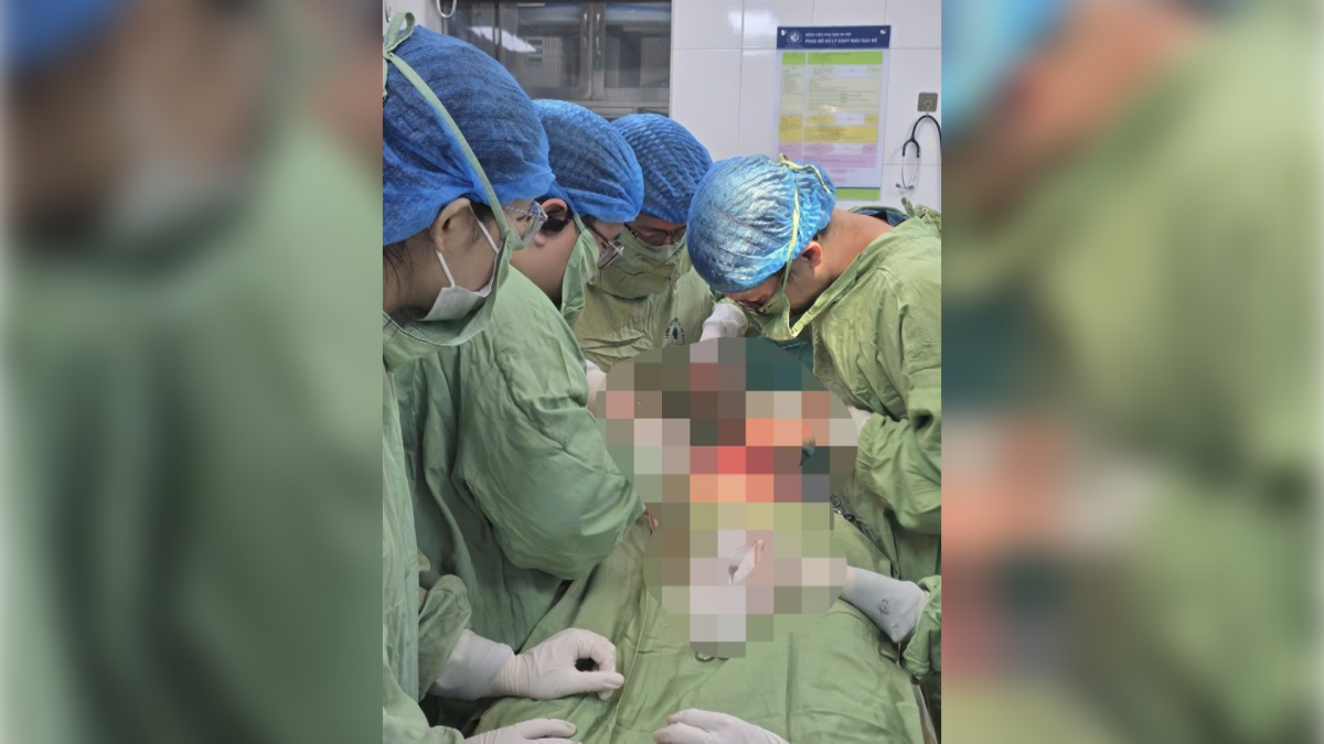 Ê-kíp phẫu thuật cho bệnh nhân vỡ tử cung vì 4 viên thuốc phá thai tự mua (Ảnh: BVCC)