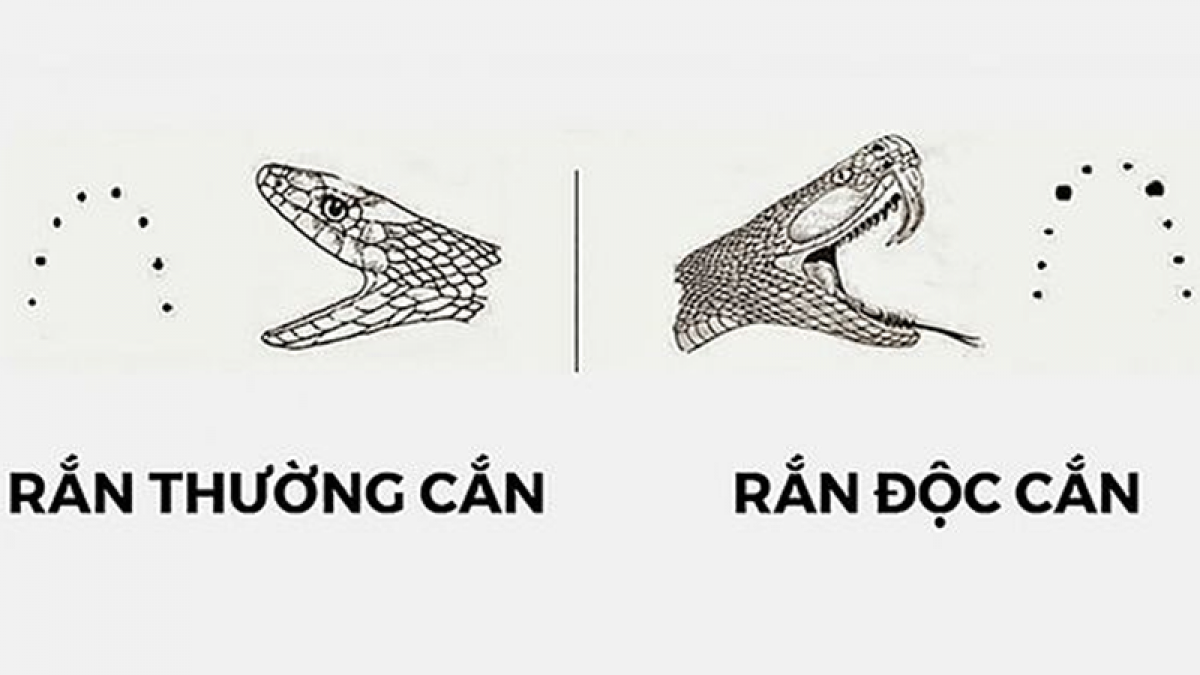 Vết cắn của rắn độc thường thể hiện rõ 2 dấu nọc độc, còn rắng thường sẽ có hình hàm răng. Ảnh: Internet