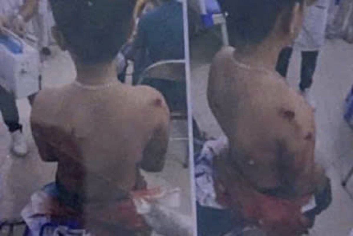 Anh T. đau xót khi trên người con có nhiều vết thương do bạn hành hung (Ảnh: FB nhân vật)