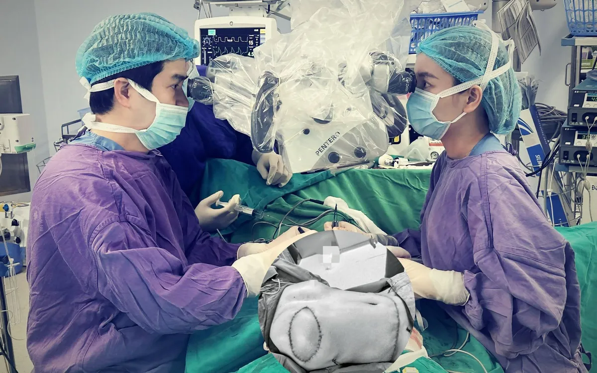 Ca vi phẫu tái tạo tuyến vú (Ảnh: Bệnh viện TWQĐ 108)