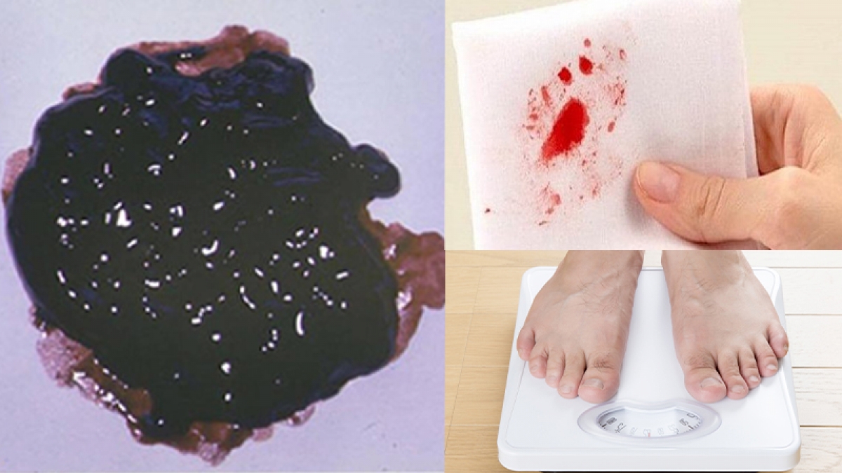 Không nên chủ quan khi trẻ có dấu hiệu mắc bệnh đường tiêu hóa. Ảnh: Internet