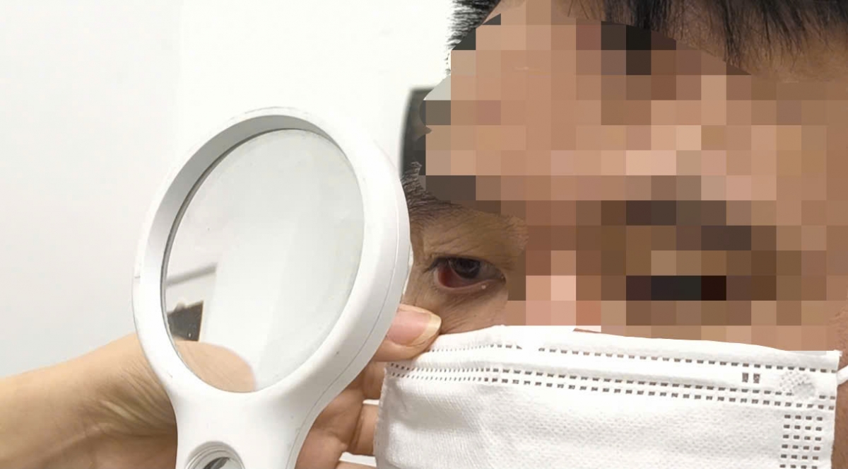 Bệnh nhân được thăm khám tại Bệnh viện Bệnh nhiệt đới TW (Ảnh: BVCC)