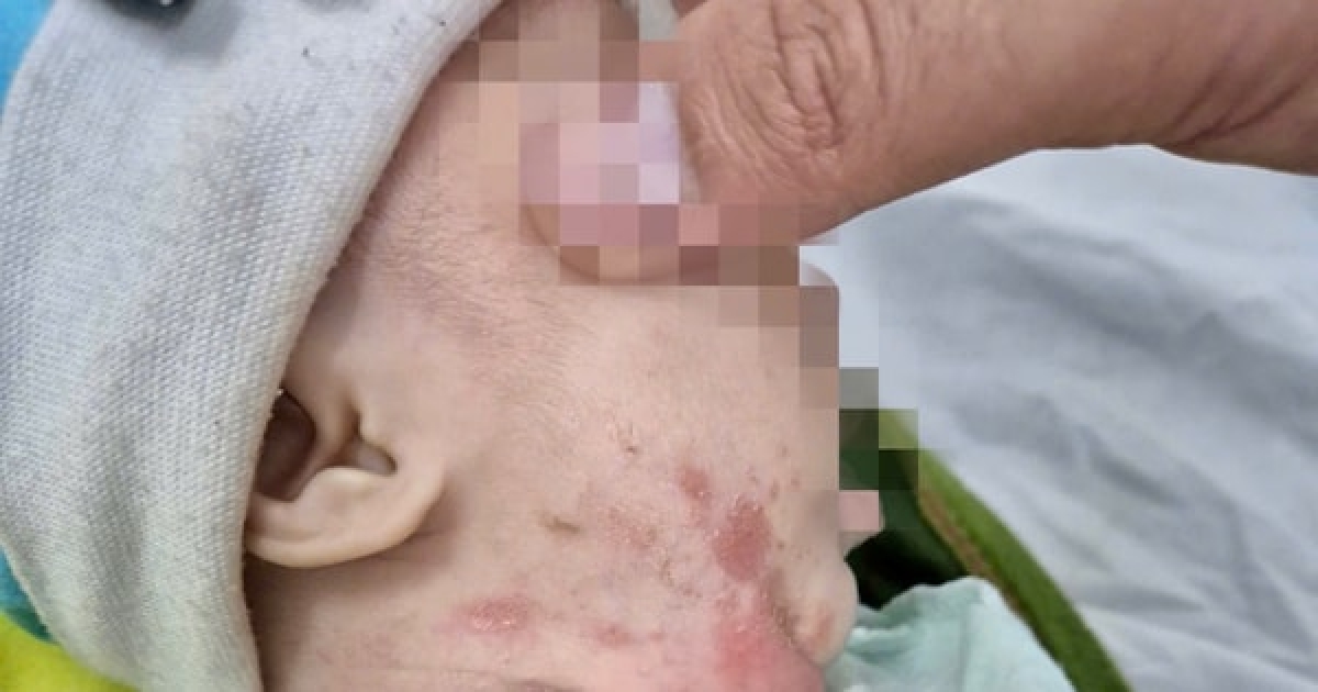 Trẻ được khám sàng lọc bệnh giang mai sớm sẽ phòng ngừa những biến chứng đối với sức khỏe. Ảnh: Báo Hà Nội mới