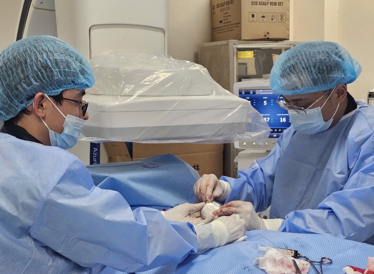 BS Bùi Đức Thịnh cùng ekip thực hiện đặt máy phá rung tự động cho bệnh nhân L.T.K. Ảnh: BSCC