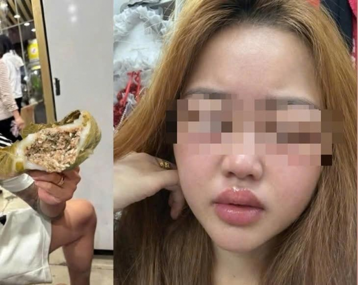 Nhiều người bị dị ứng, ngộ độc sau khi ăn bánh trứng kiến. (Ảnh Internet)