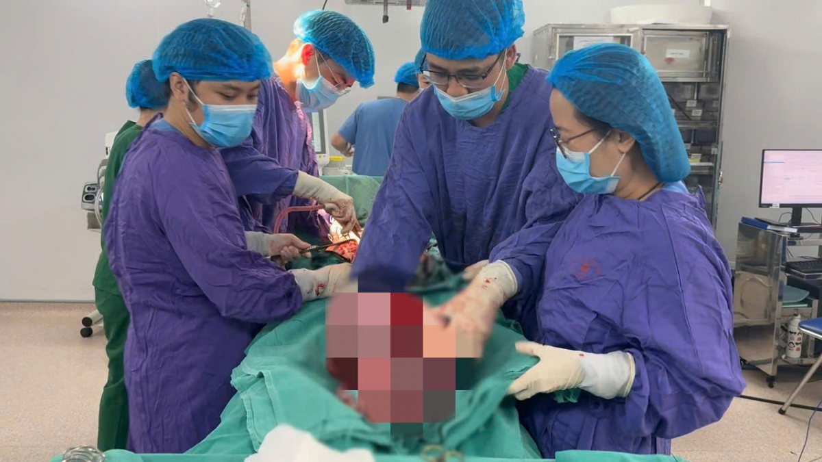Các bác sĩ khoa Ngoại Tổng hợp đã xử lý bóc tách thành công khối u nặng 9kg. Ảnh: BVCC