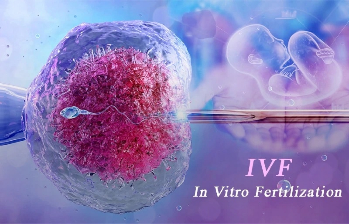 Đến nay chưa có cơ sở khẳng định mối liên hệ trực tiếp giữa IVF và ung thư (Ảnh: Internet)