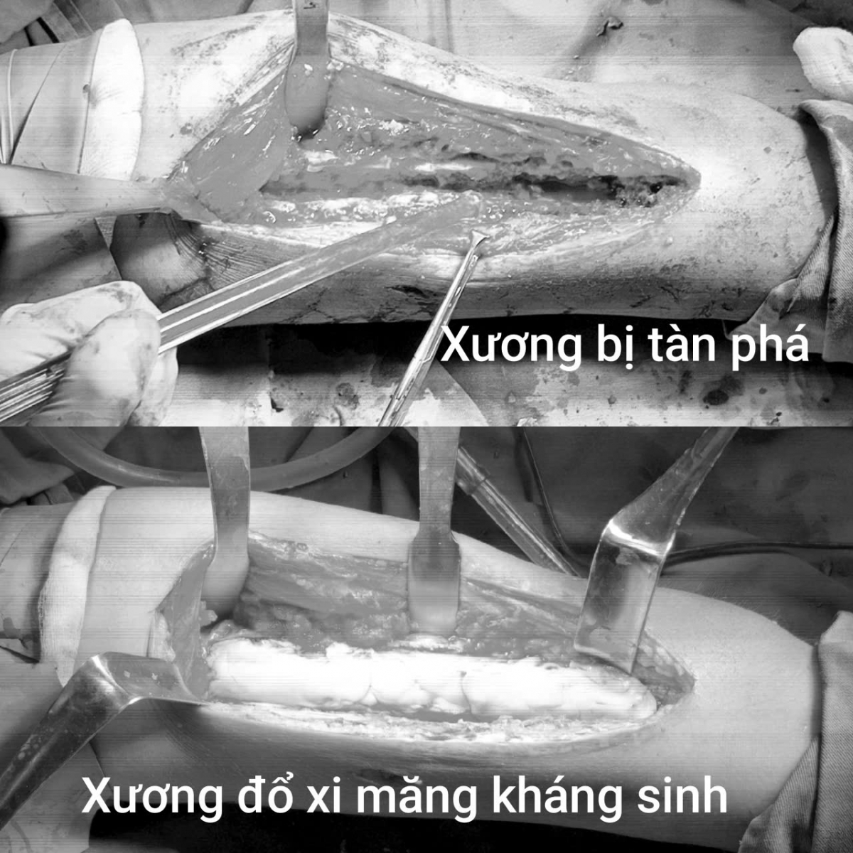 Ảnh: BVCC
