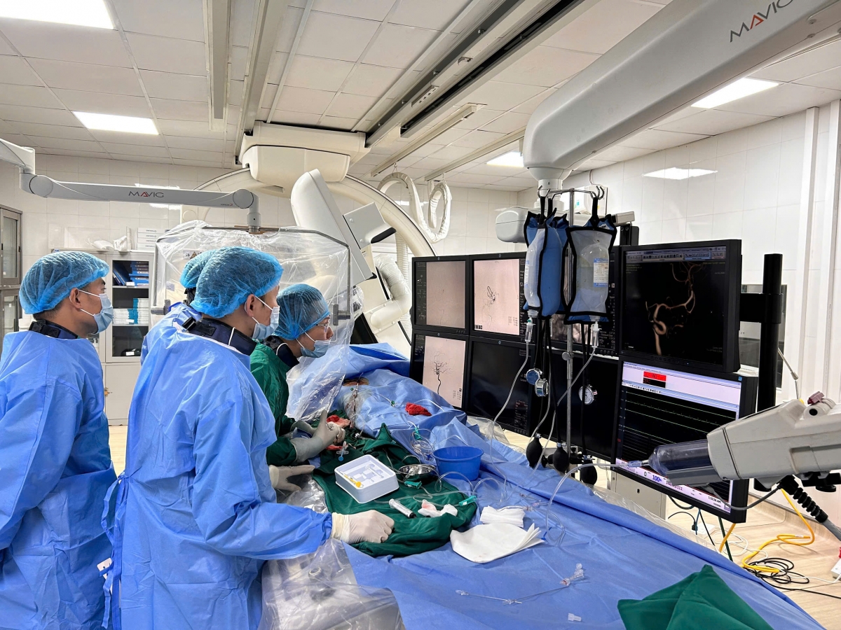 E-kip Đơn nguyên Can thiệp mạch thực hiện kỹ thuật đặt stent đổi hướng dòng chảy (Flow Diverter) để điều trị cho bệnh nhân (Ảnh: BVCC)