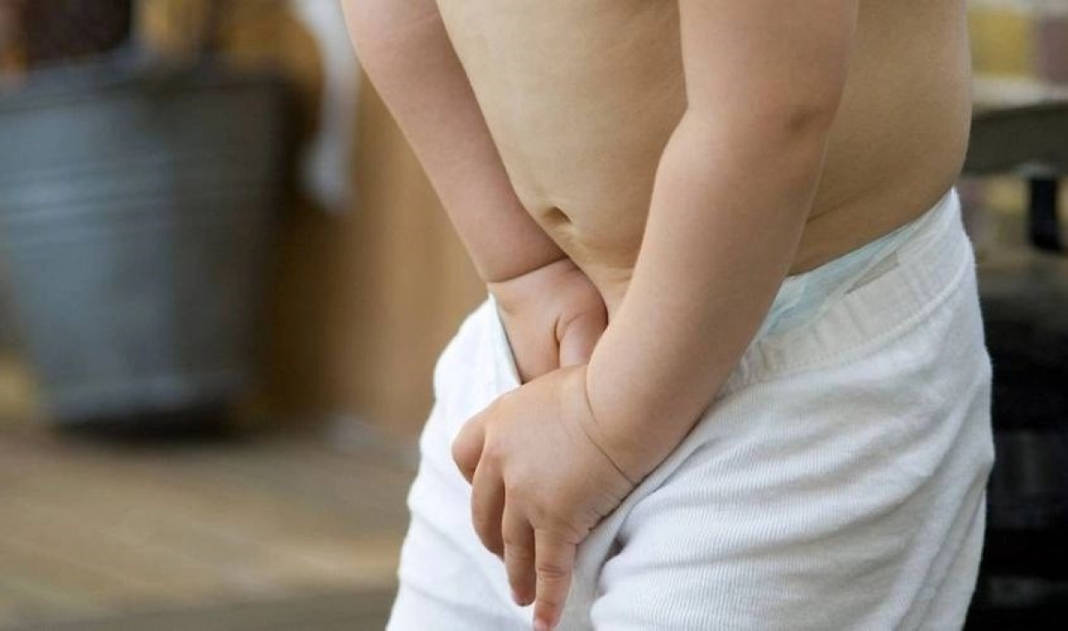Cứ 100 bé trai chào đời, có 2-5 trẻ mắc dị tật cơ quan sinh dục
(Ảnh minh họa do AI tạo)