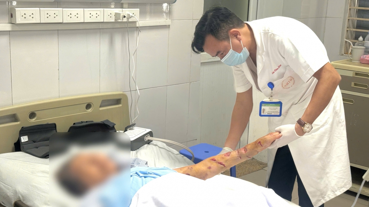 Bệnh nhân được chăm sóc vết thương tại Bệnh viện Bệnh nhiệt đới TW - Ảnh: BVCC
