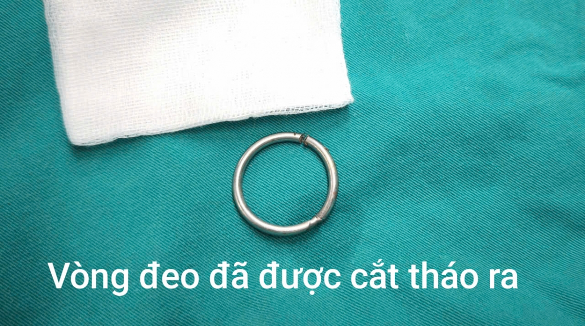 (Ảnh: BVCC)